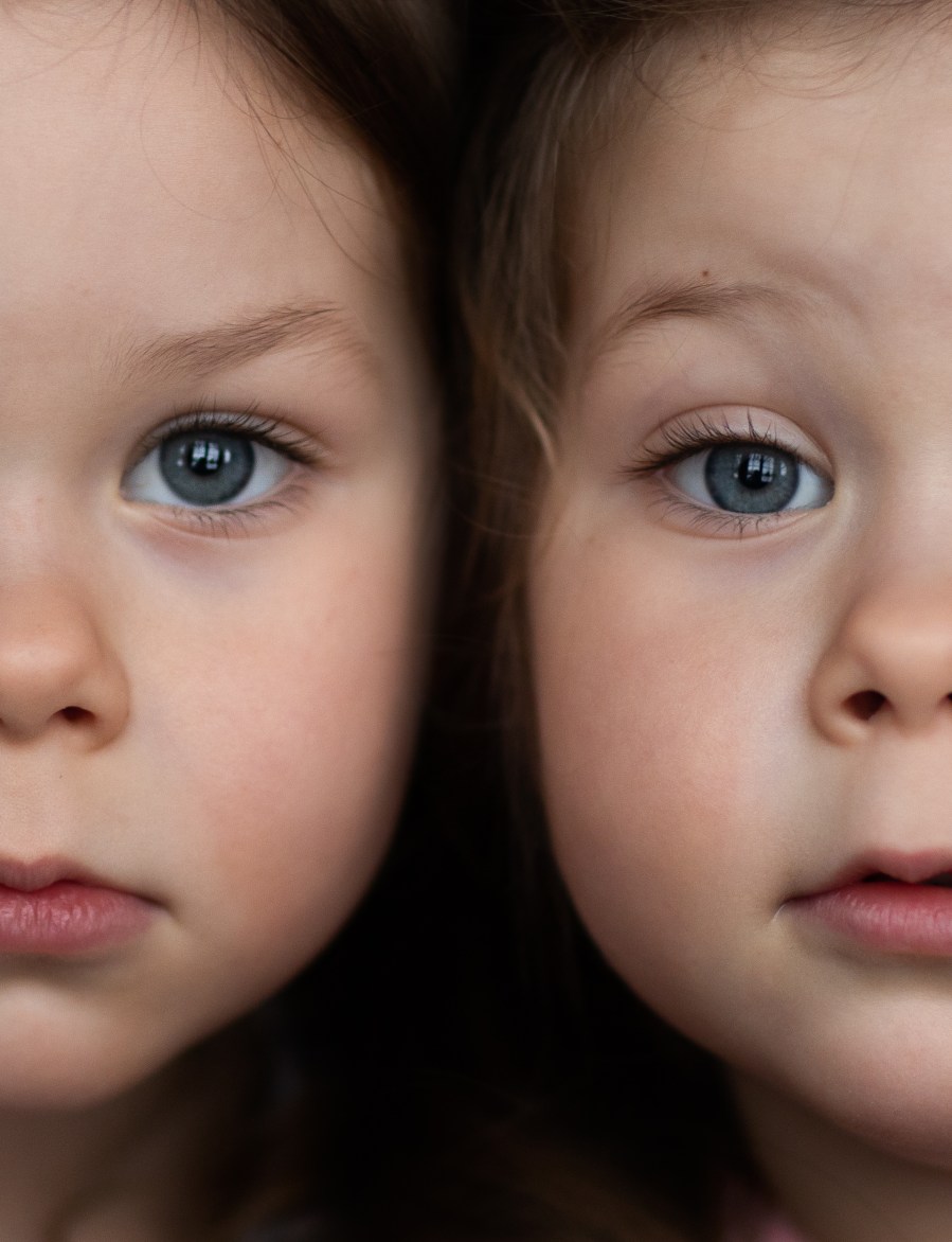 Abby And Brittany Hensel Are The World's Most Famous Conjoined Twins